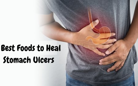 அல்சரை குறைக்க கூடிய 5 உணவுகள்  | 5 Best Foods to Heal Stomach Ulcers